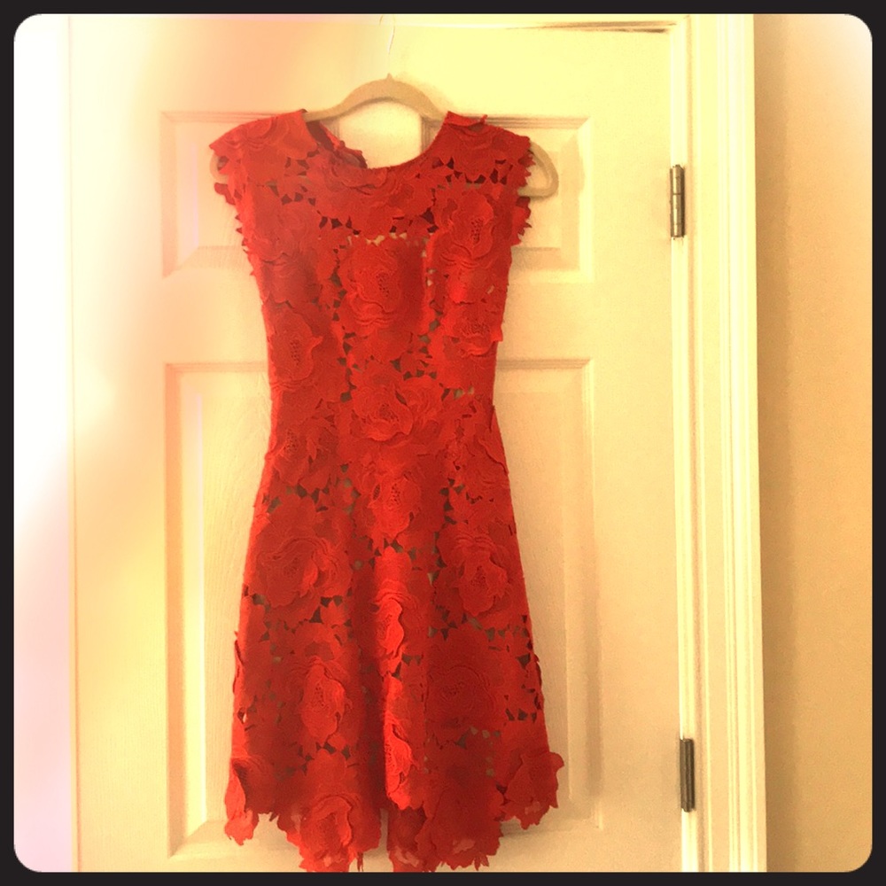 Fitted lace dress.